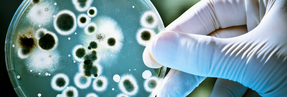 Mold microbiology lab, microbiology tests laboratories
